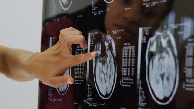 UK-CT-xray-summary