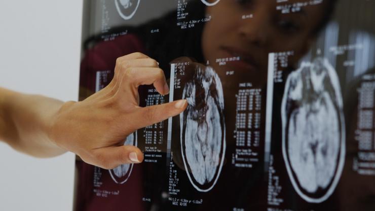 UK-CT-xray-summary